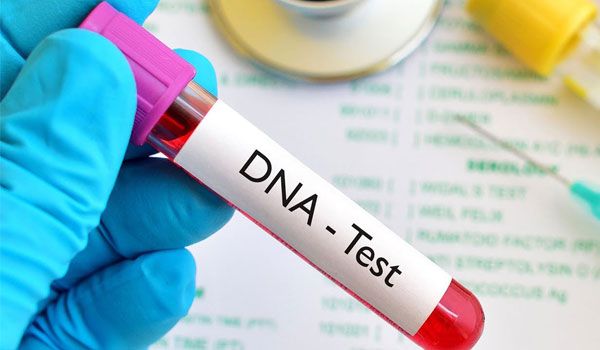 DNA Tests In Lagos