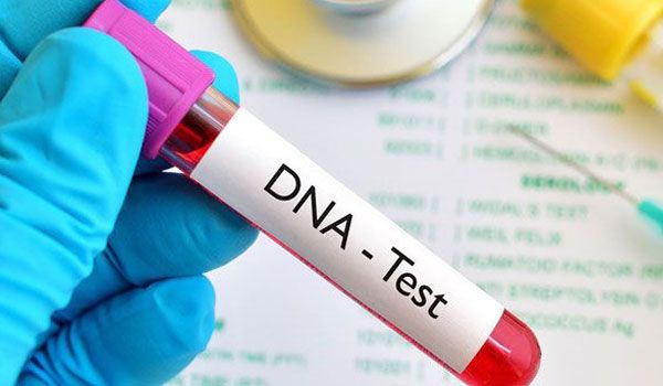 DNA Tests In Nigeria